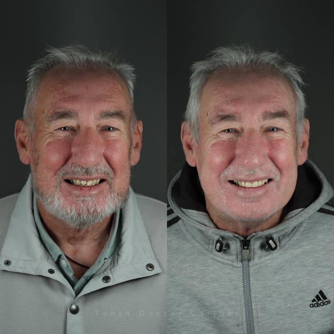 Tooth Doctor | Smile Gallery Before and after treatment