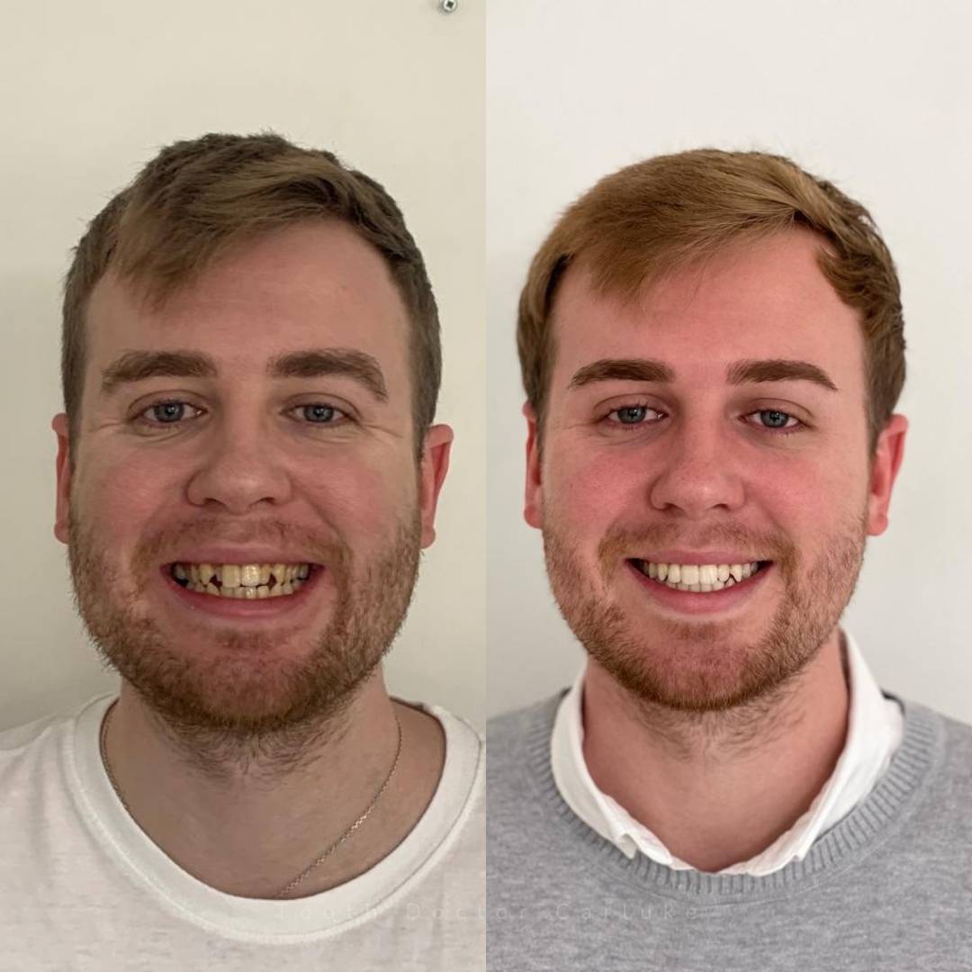 Tooth Doctor | Smile Gallery Before and after treatment
