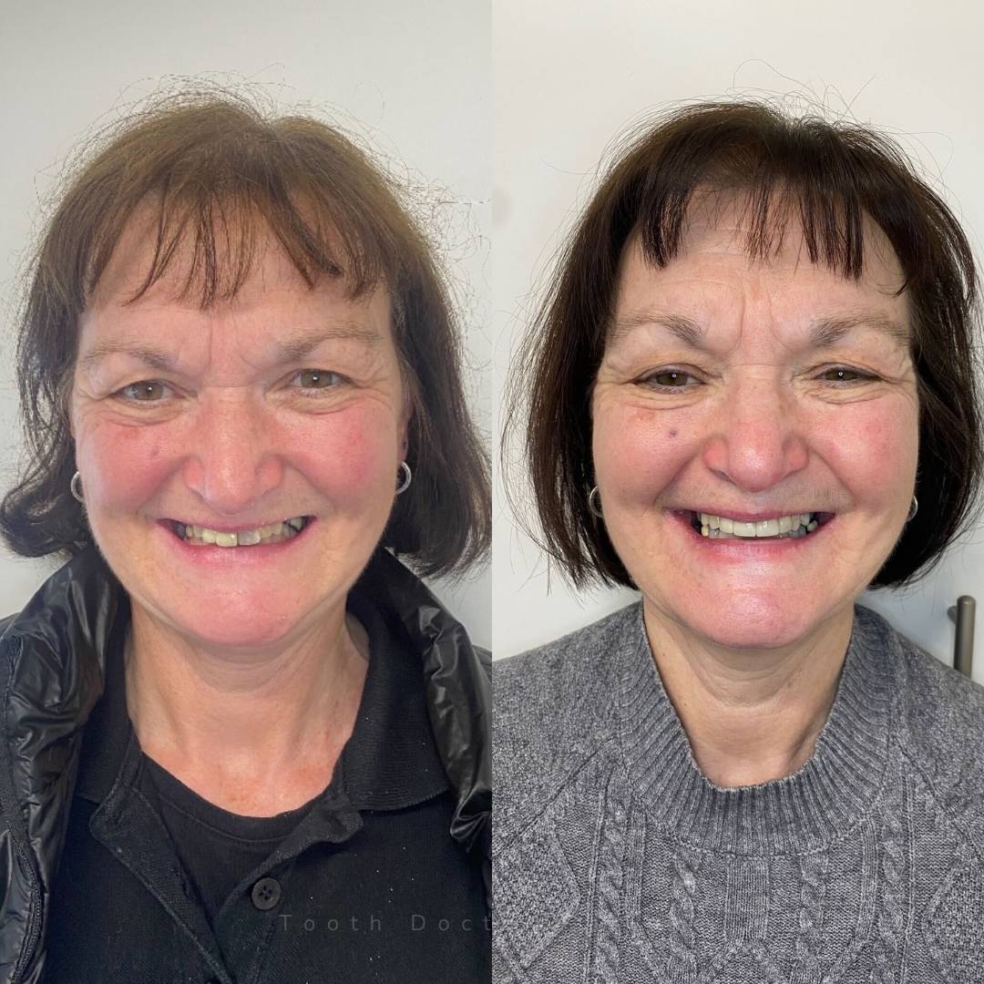 Tooth Doctor | Smile Gallery Before and after treatment
