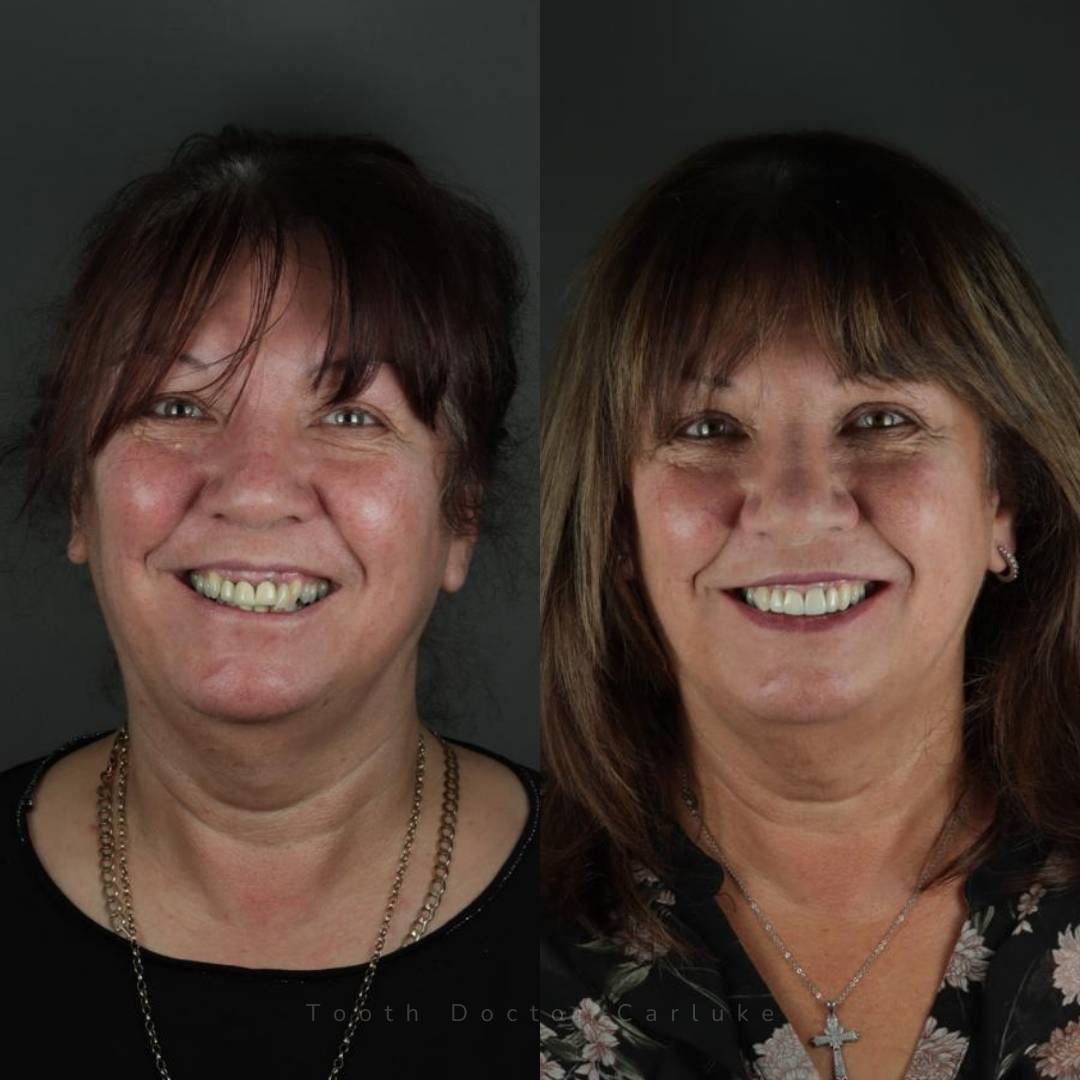 Tooth Doctor | Smile Gallery Before and after treatment