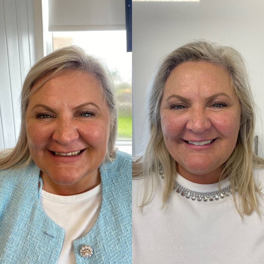 Tooth Doctor | Smile Gallery Before and after treatment
