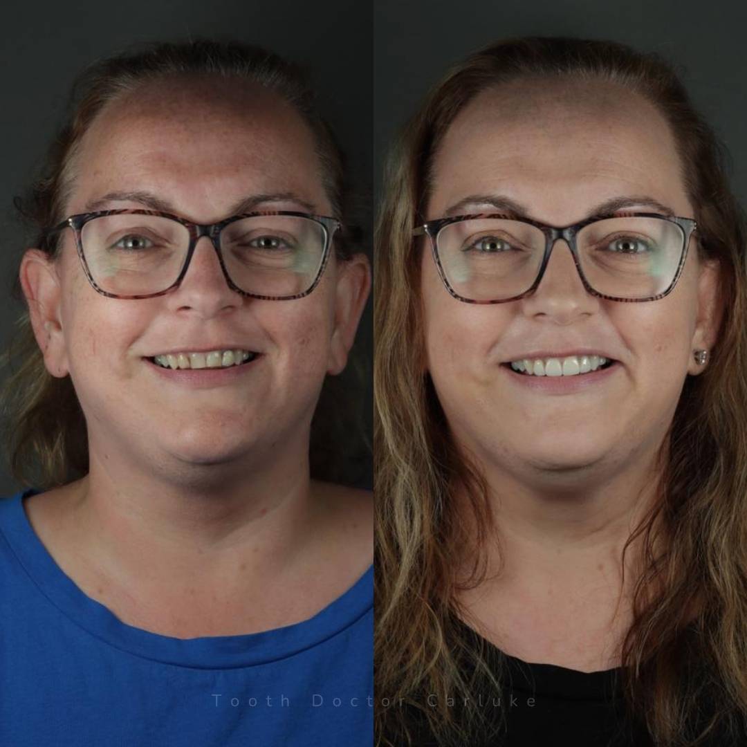 Tooth Doctor | Smile Gallery Before and after treatment