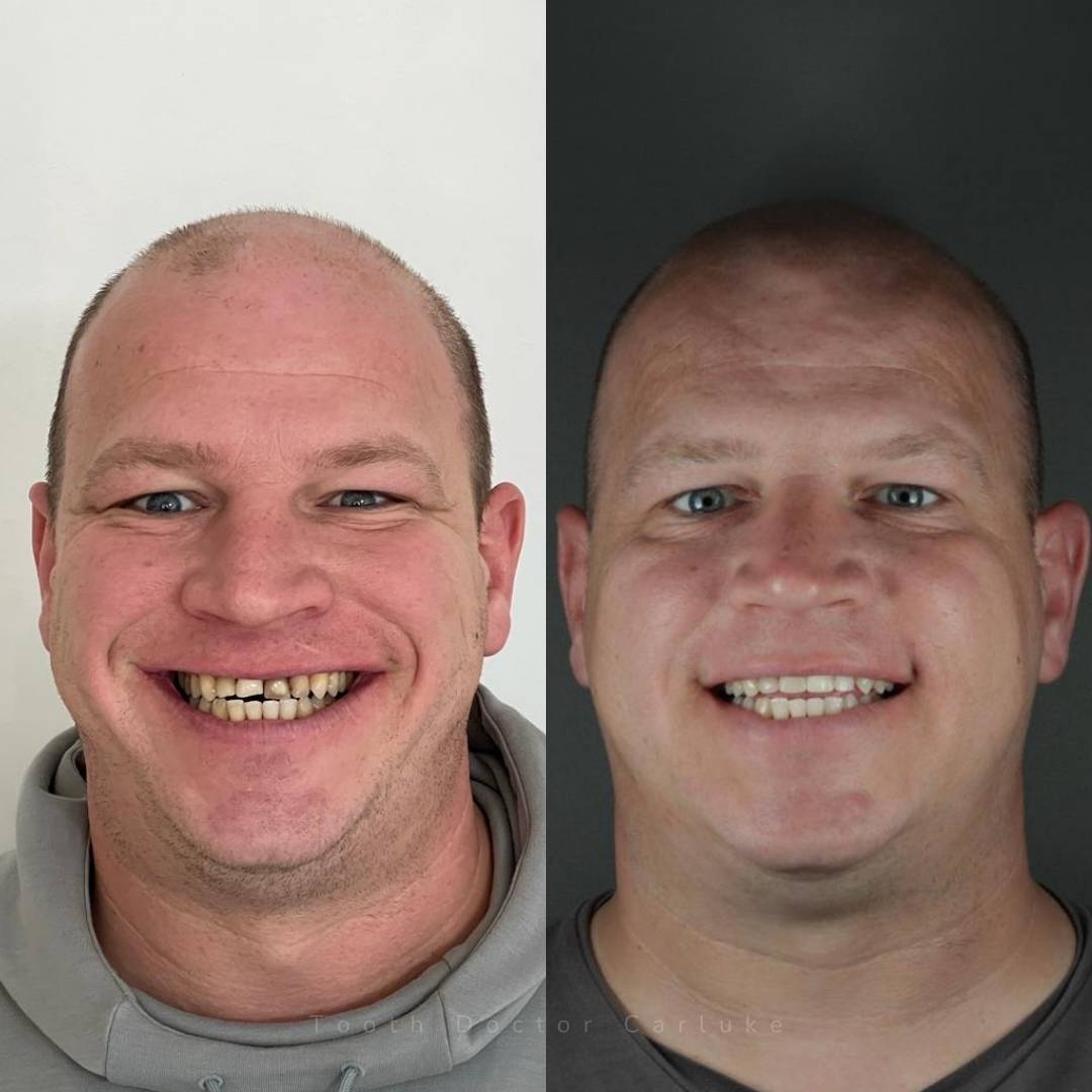 Tooth Doctor | Smile Gallery Before and after treatment
