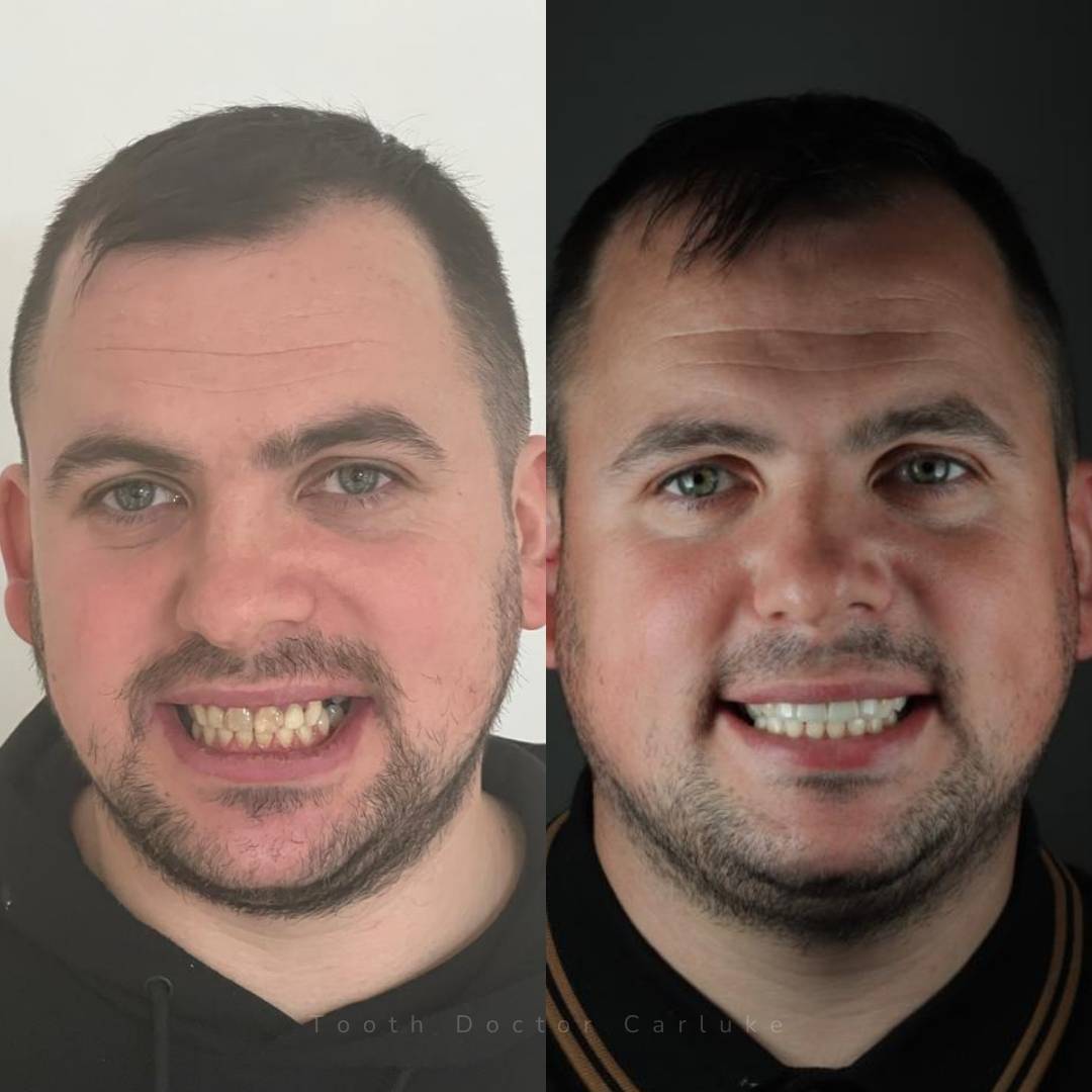 Tooth Doctor | Smile Gallery Before and after treatment
