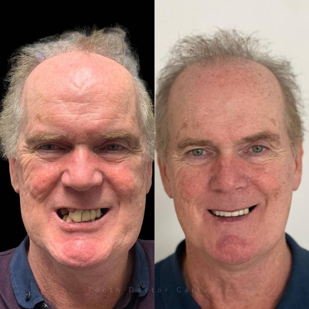 Tooth Doctor | Smile Gallery Before and after treatment