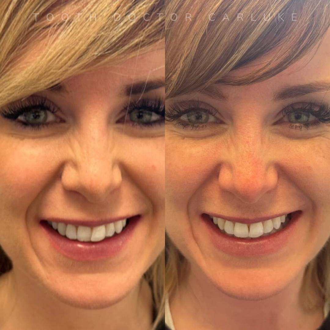 Tooth Doctor | Smile Gallery Before and after treatment