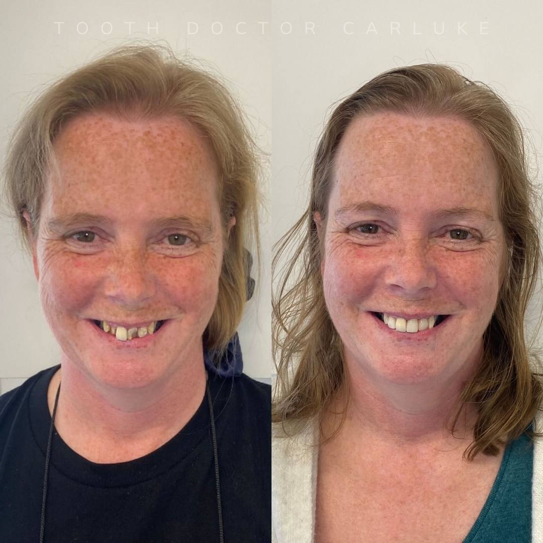 Tooth Doctor | Smile Gallery Before and after treatment