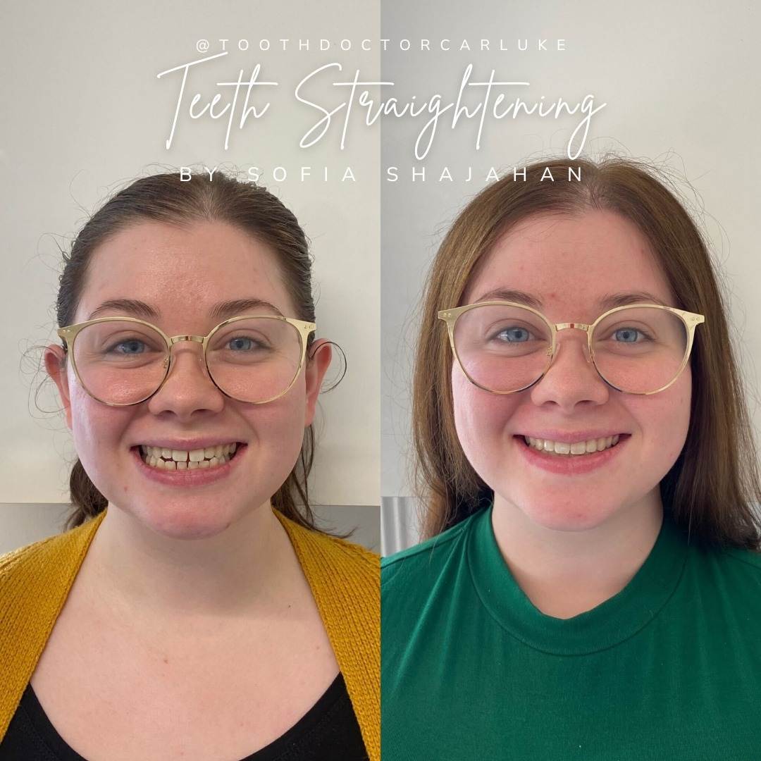 Tooth Doctor | Smile Gallery Before and after treatment