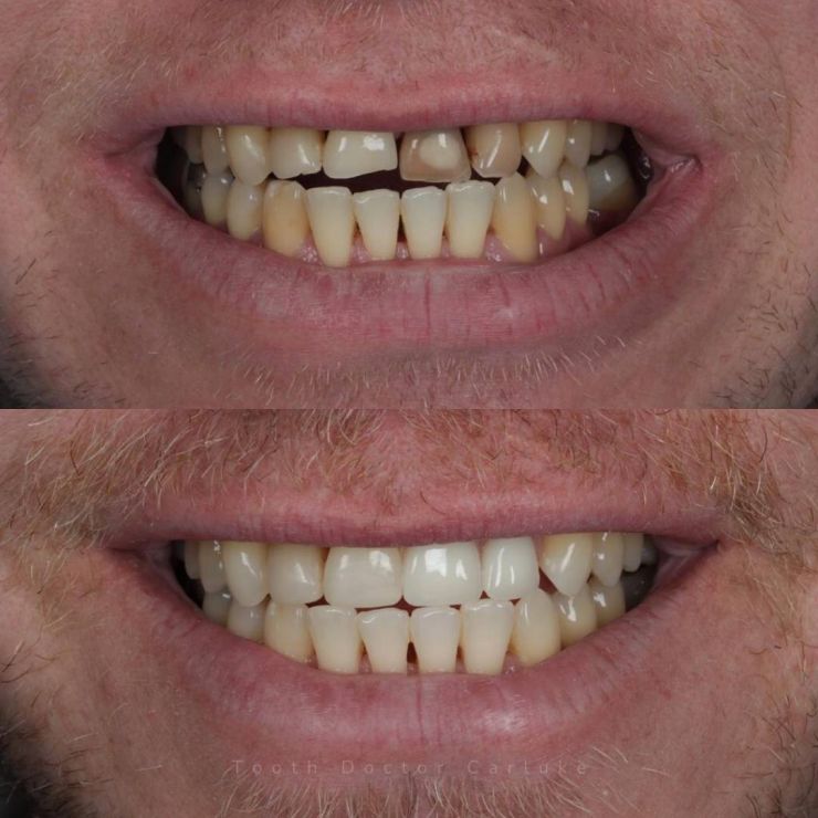 Tooth Doctor | Smile Gallery Transforming Smiles