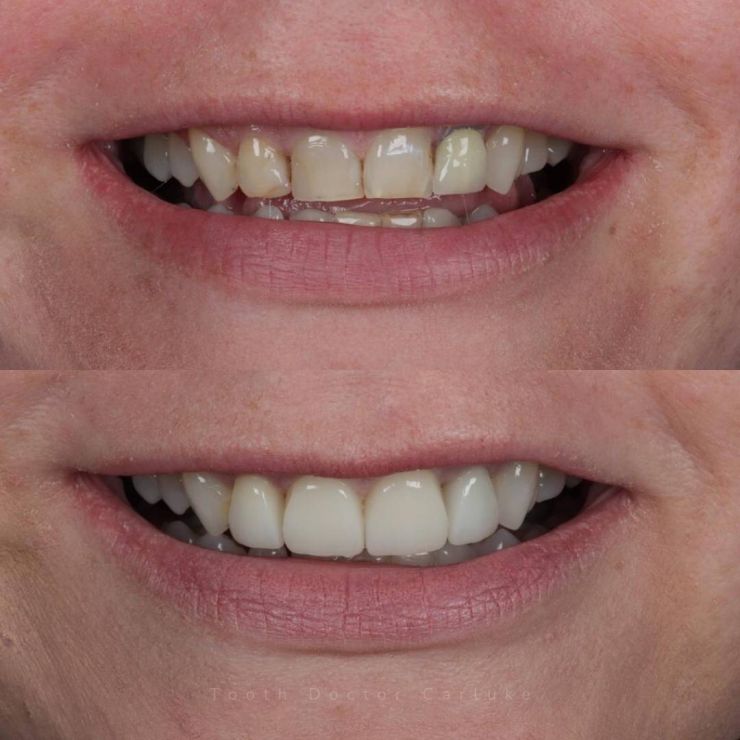Tooth Doctor | Smile Gallery Transforming Smiles