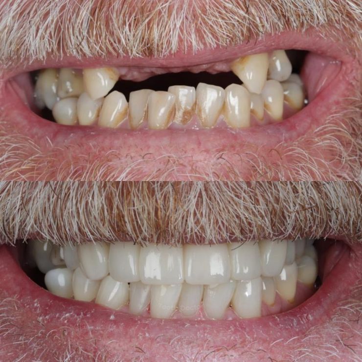 Tooth Doctor | Smile Gallery Transforming Smiles