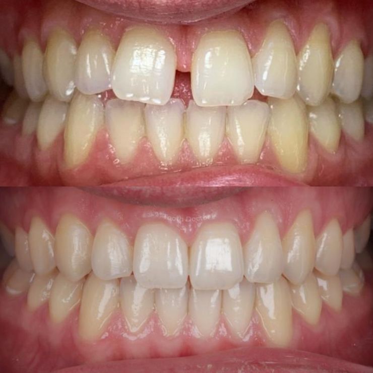 Tooth Doctor | Smile Gallery Transforming Smiles