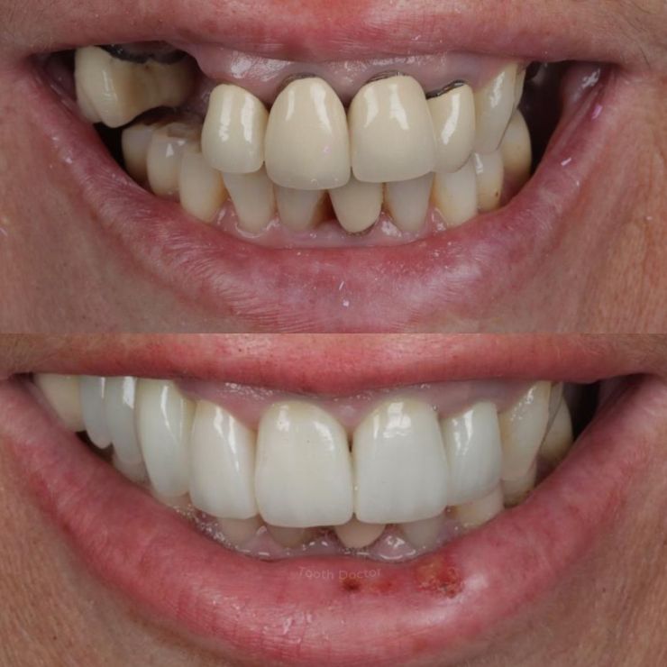 Tooth Doctor | Smile Gallery Transforming Smiles