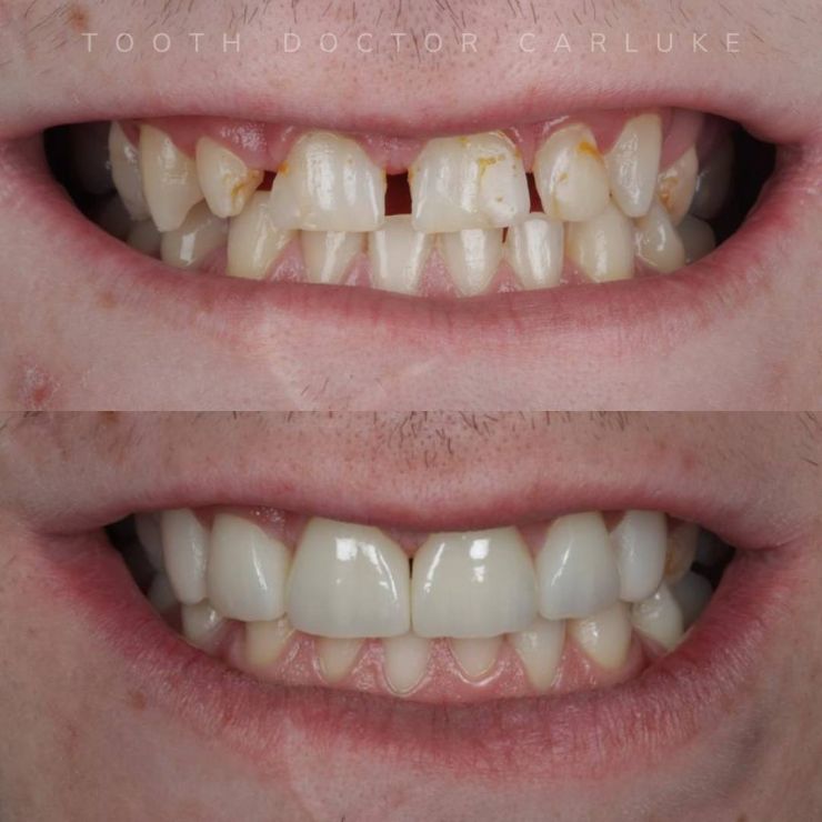 Tooth Doctor | Smile Gallery Transforming Smiles
