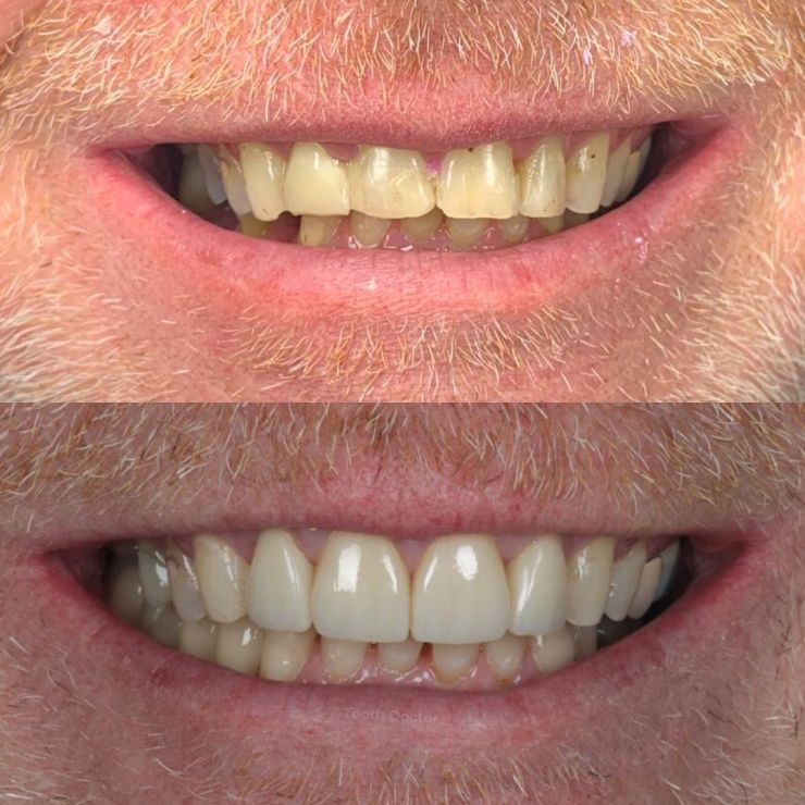 Tooth Doctor | Smile Gallery Transforming Smiles