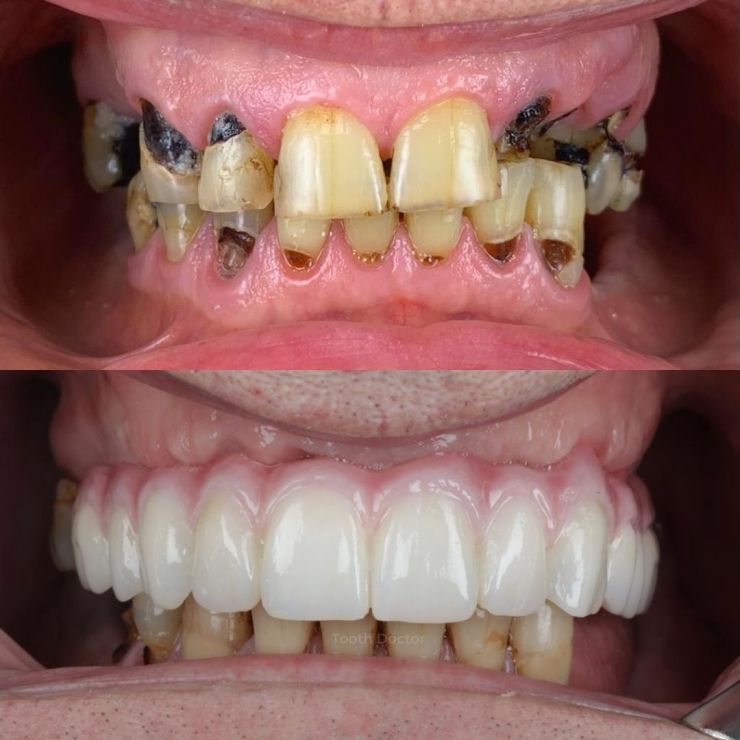 Tooth Doctor | Smile Gallery Transforming Smiles