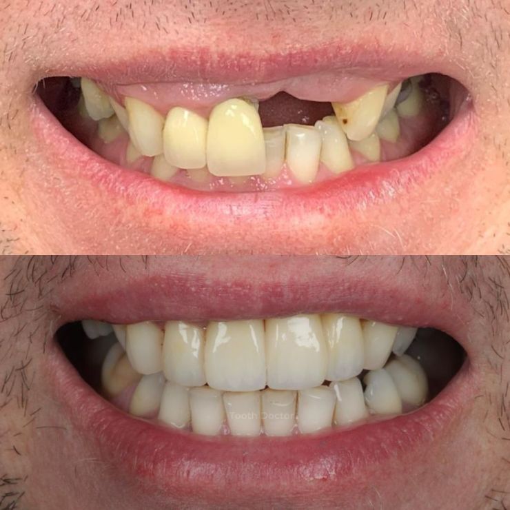 Tooth Doctor | Smile Gallery Transforming Smiles