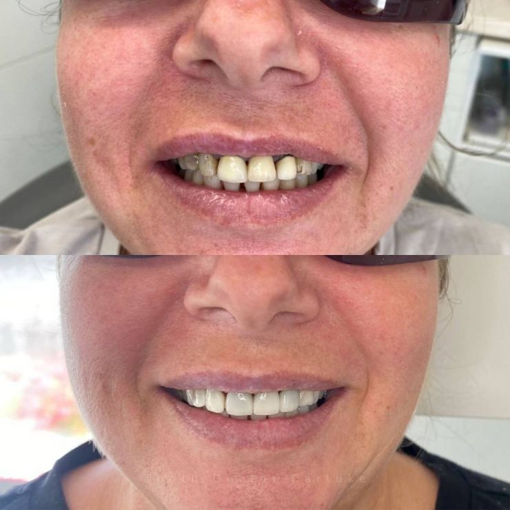 Tooth Doctor | Smile Gallery Transforming Smiles