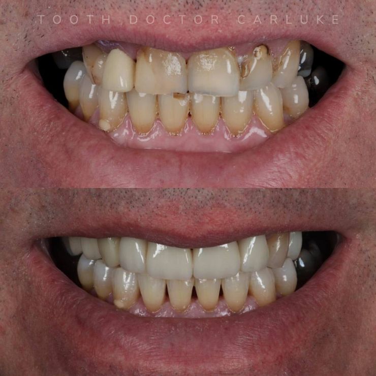 Tooth Doctor | Smile Gallery Transforming Smiles