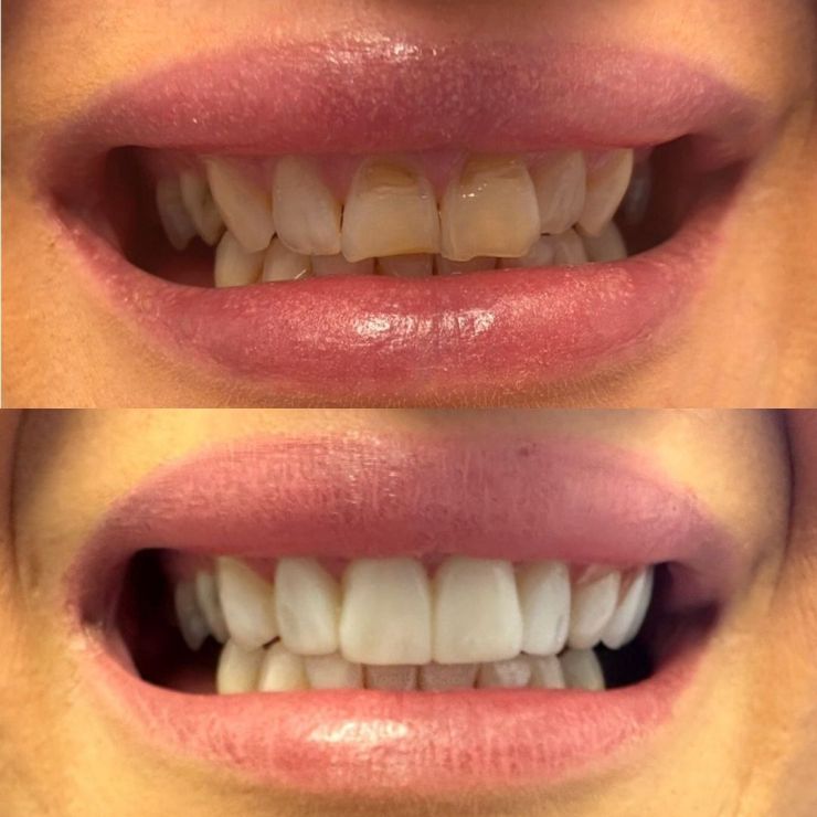 Tooth Doctor | Smile Gallery Transforming Smiles