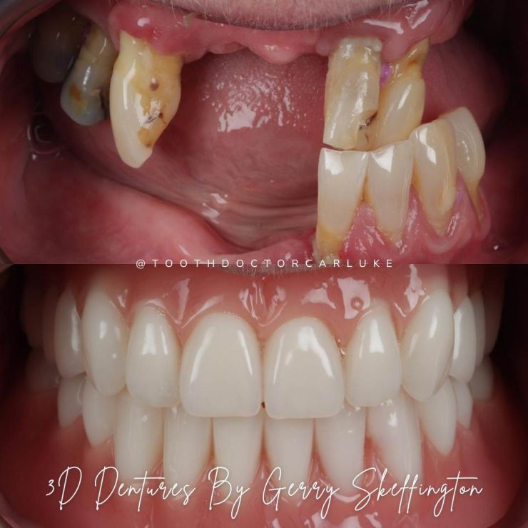 Tooth Doctor | Smile Gallery Transforming Smiles