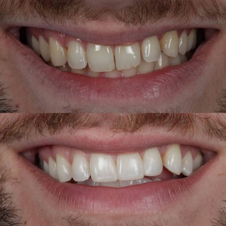 Tooth Doctor | Smile Gallery Transforming Smiles