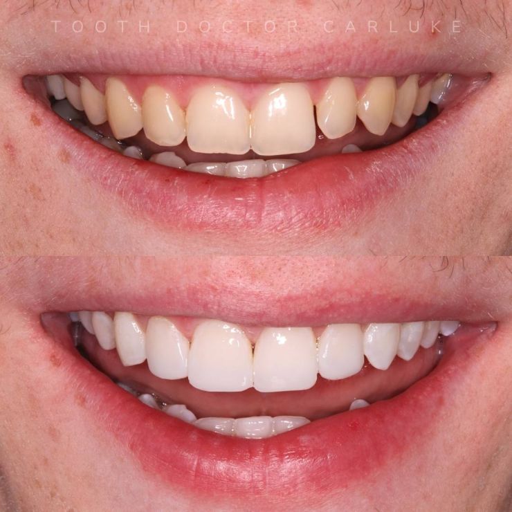 Tooth Doctor | Smile Gallery Transforming Smiles