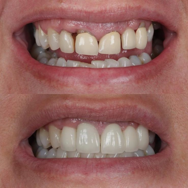 Tooth Doctor | Smile Gallery Transforming Smiles