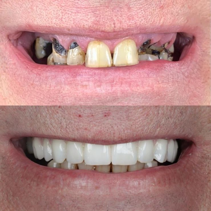 Tooth Doctor | Smile Gallery Transforming Smiles