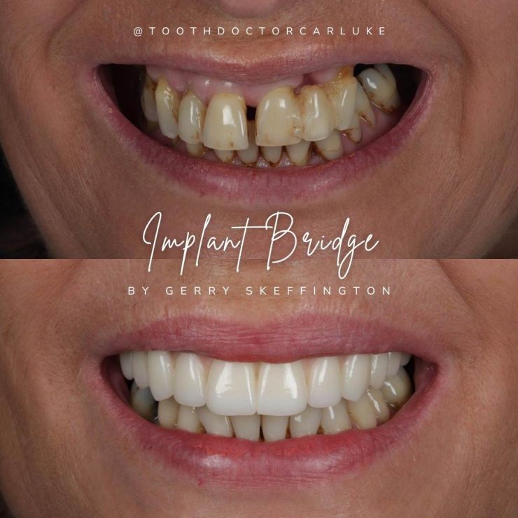 Tooth Doctor | Smile Gallery Transforming Smiles