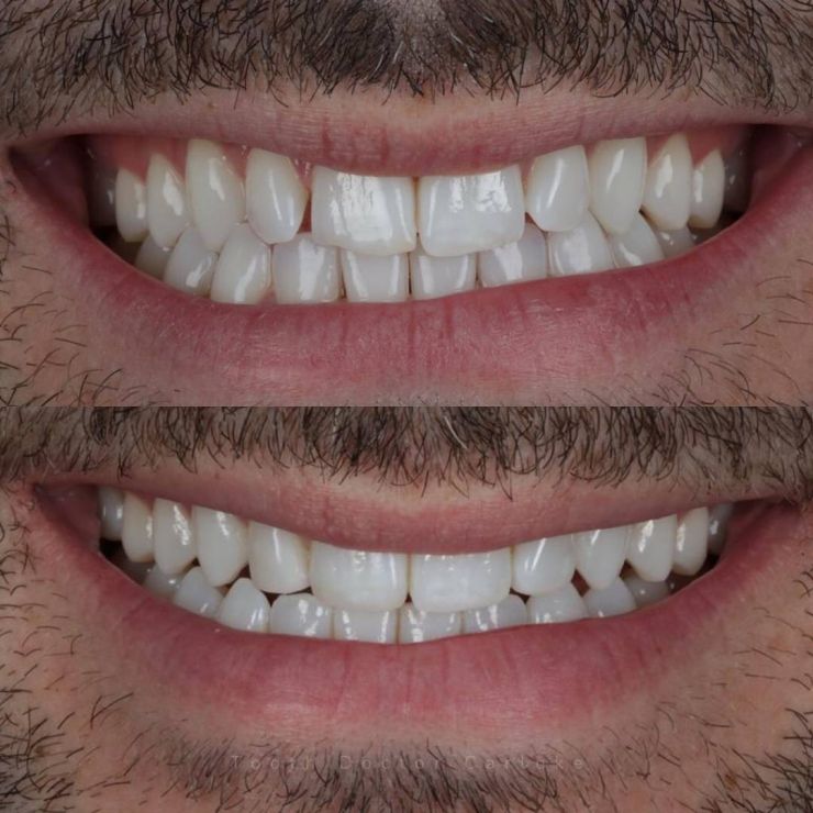 Tooth Doctor | Smile Gallery Transforming Smiles