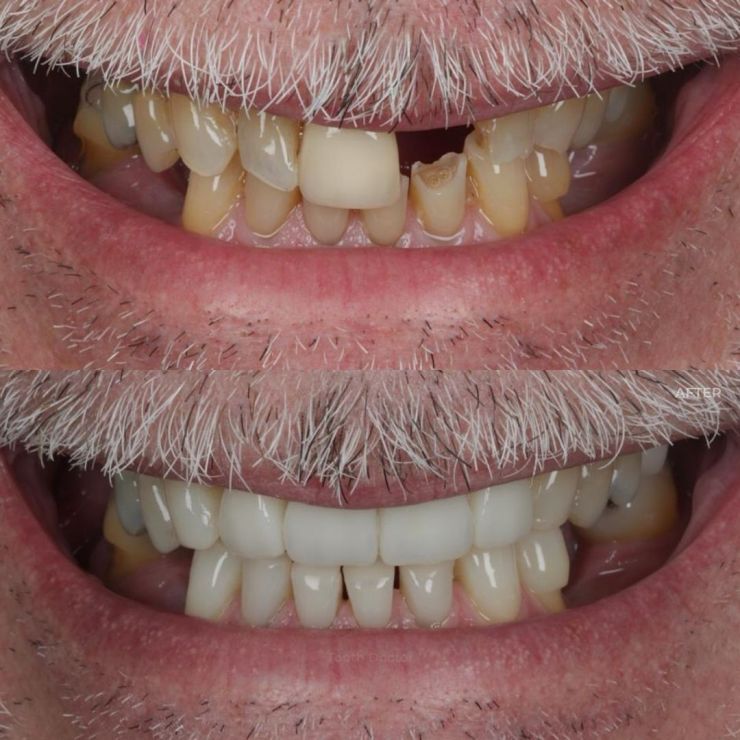 Tooth Doctor | Smile Gallery Transforming Smiles