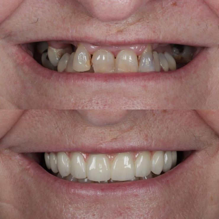 Tooth Doctor | Smile Gallery Transforming Smiles