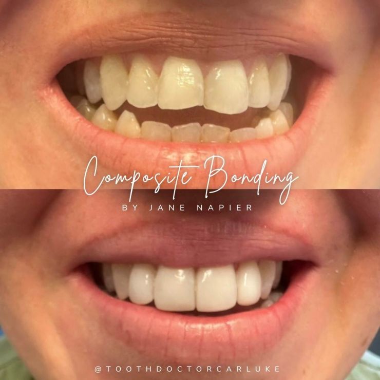 Tooth Doctor | Smile Gallery Transforming Smiles