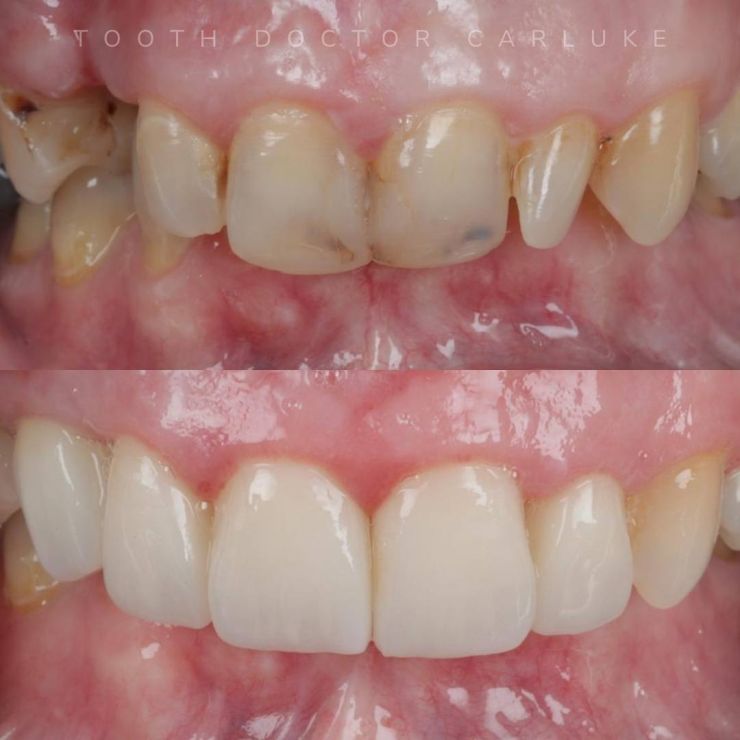 Tooth Doctor | Smile Gallery Transforming Smiles