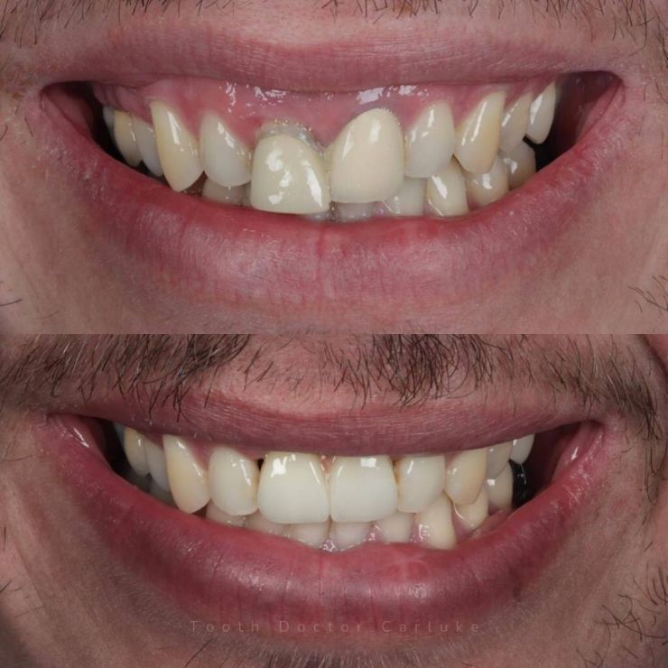 Tooth Doctor | Smile Gallery Transforming Smiles