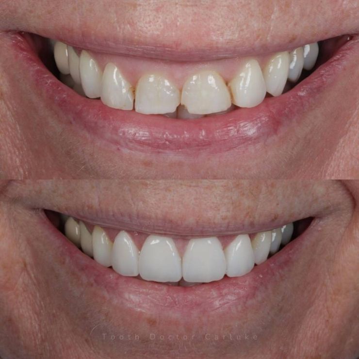 Tooth Doctor | Smile Gallery Transforming Smiles
