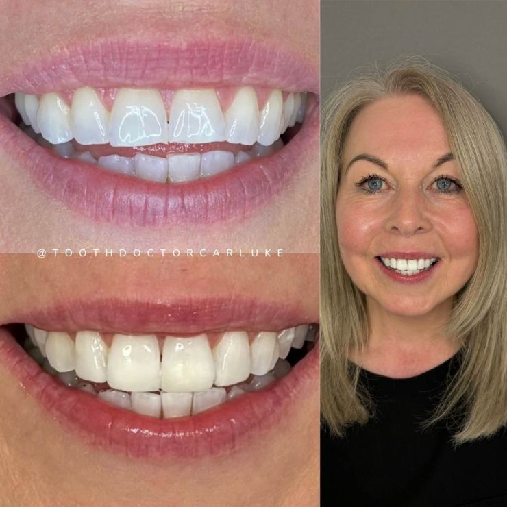 Tooth Doctor | Smile Gallery Transforming Smiles