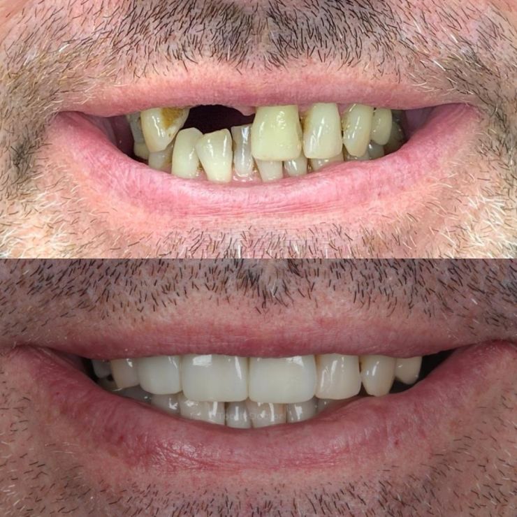 Tooth Doctor | Smile Gallery Transforming Smiles