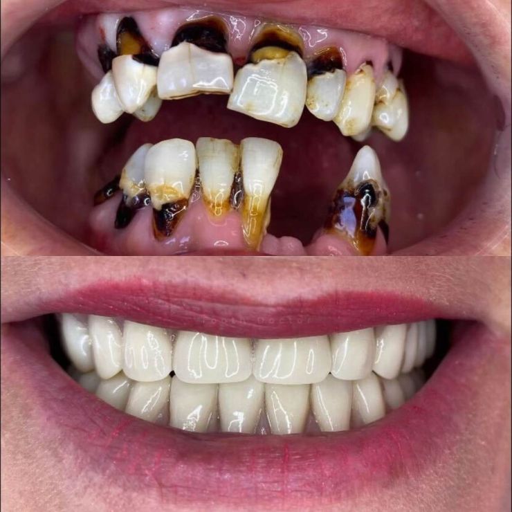 Tooth Doctor | Smile Gallery Transforming Smiles