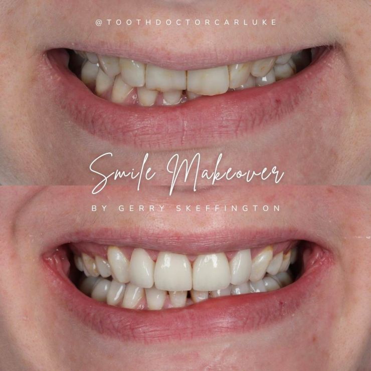Tooth Doctor | Smile Gallery Transforming Smiles