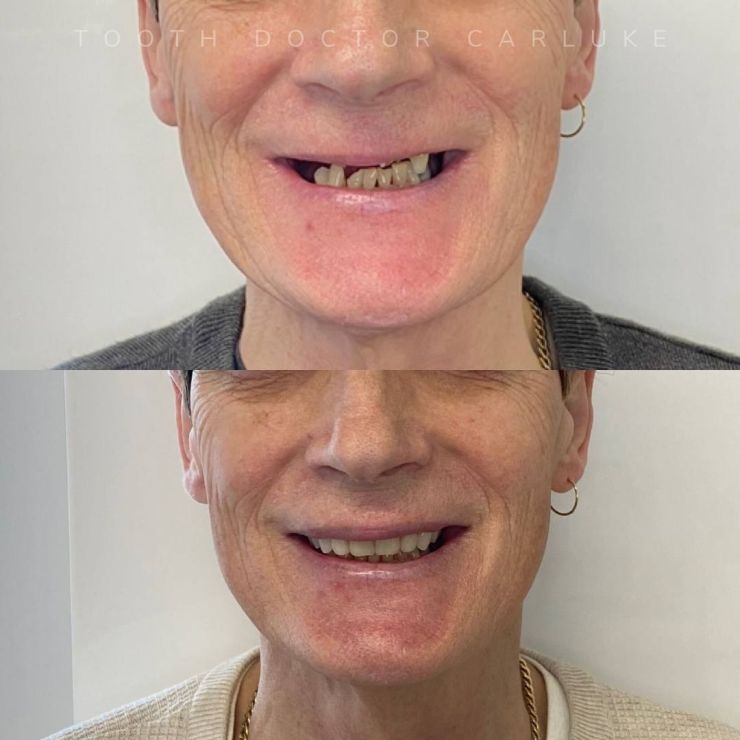 Tooth Doctor | Smile Gallery Transforming Smiles