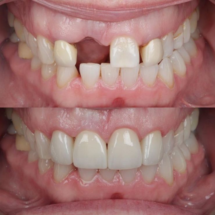 Tooth Doctor | Smile Gallery Transforming Smiles