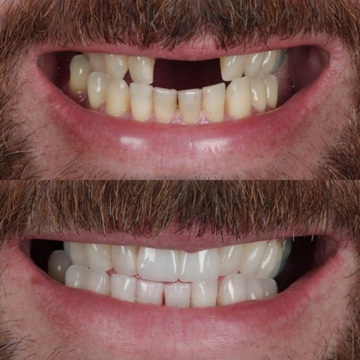 Tooth Doctor | Smile Gallery Transforming Smiles