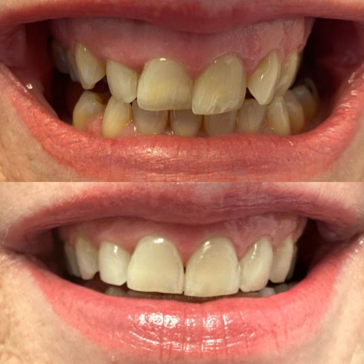 Tooth Doctor | Smile Gallery Transforming Smiles