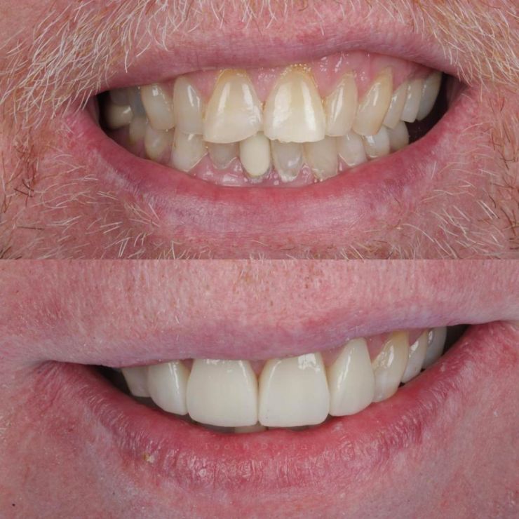 Tooth Doctor | Smile Gallery Transforming Smiles