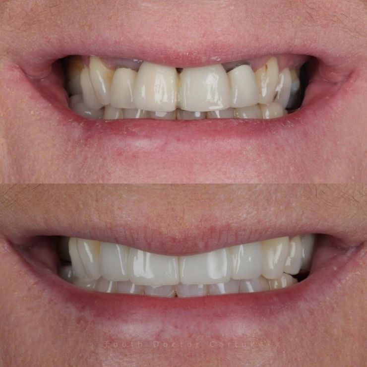 Tooth Doctor | Smile Gallery Transforming Smiles