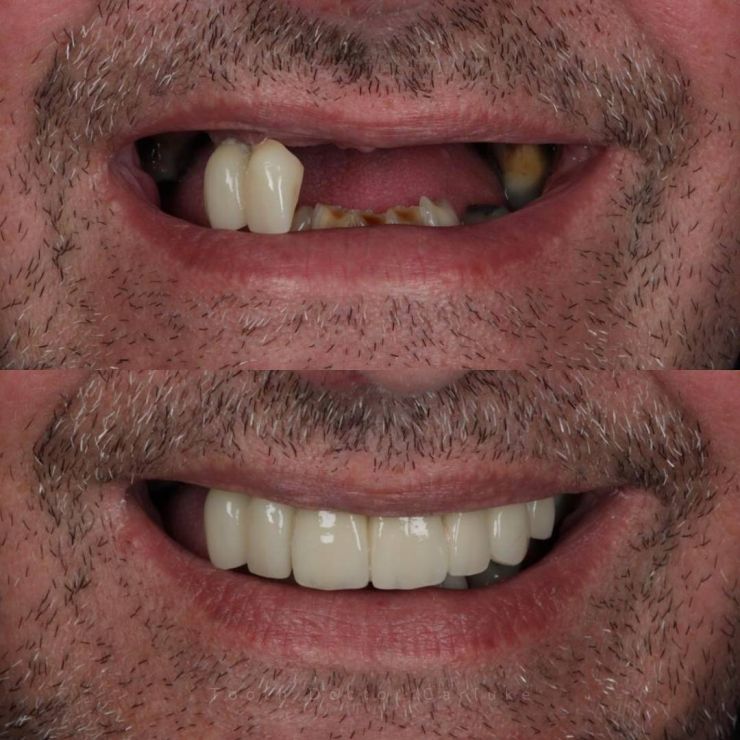 Tooth Doctor | Smile Gallery Transforming Smiles