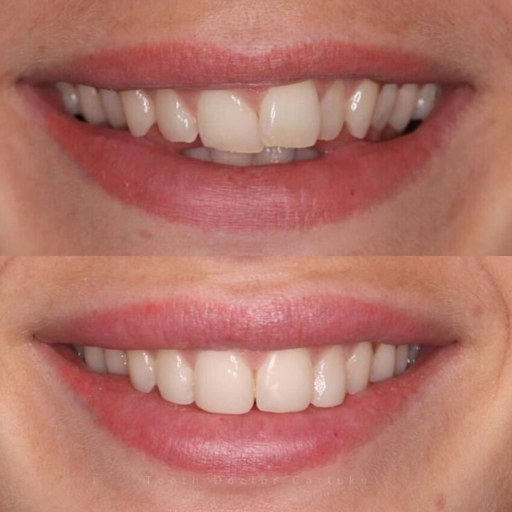 Tooth Doctor | Smile Gallery Transforming Smiles