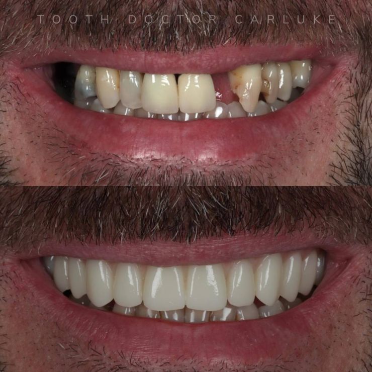 Tooth Doctor | Smile Gallery Transforming Smiles